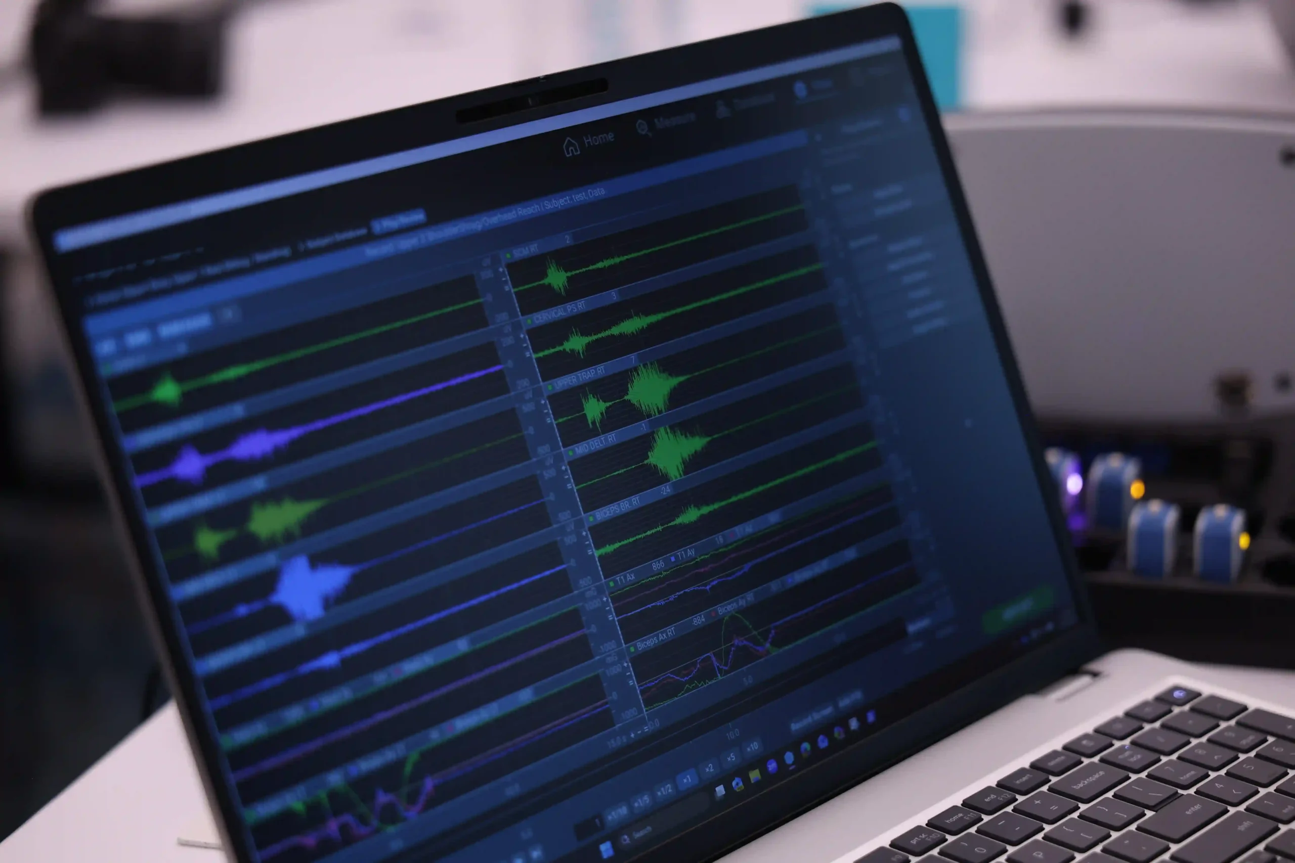 Laptop displaying multiple live EMG channels